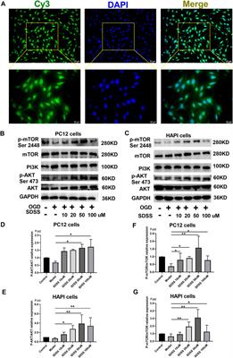 Sodium danshensu attenuates cerebral ischemia–reperfusion injury by targeting AKT1